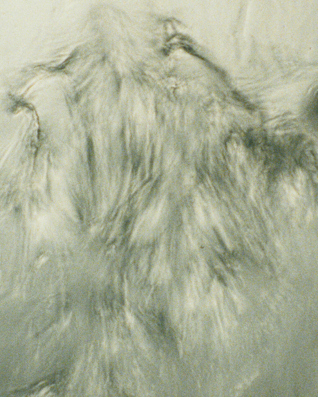 STONE ISLAND CORROSION TREATMENT