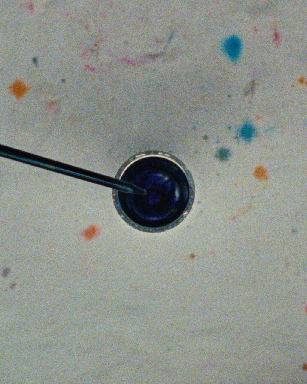 STONE ISLAND CORROSION TREATMENT